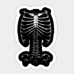 Skeleton X-Ray Sticker